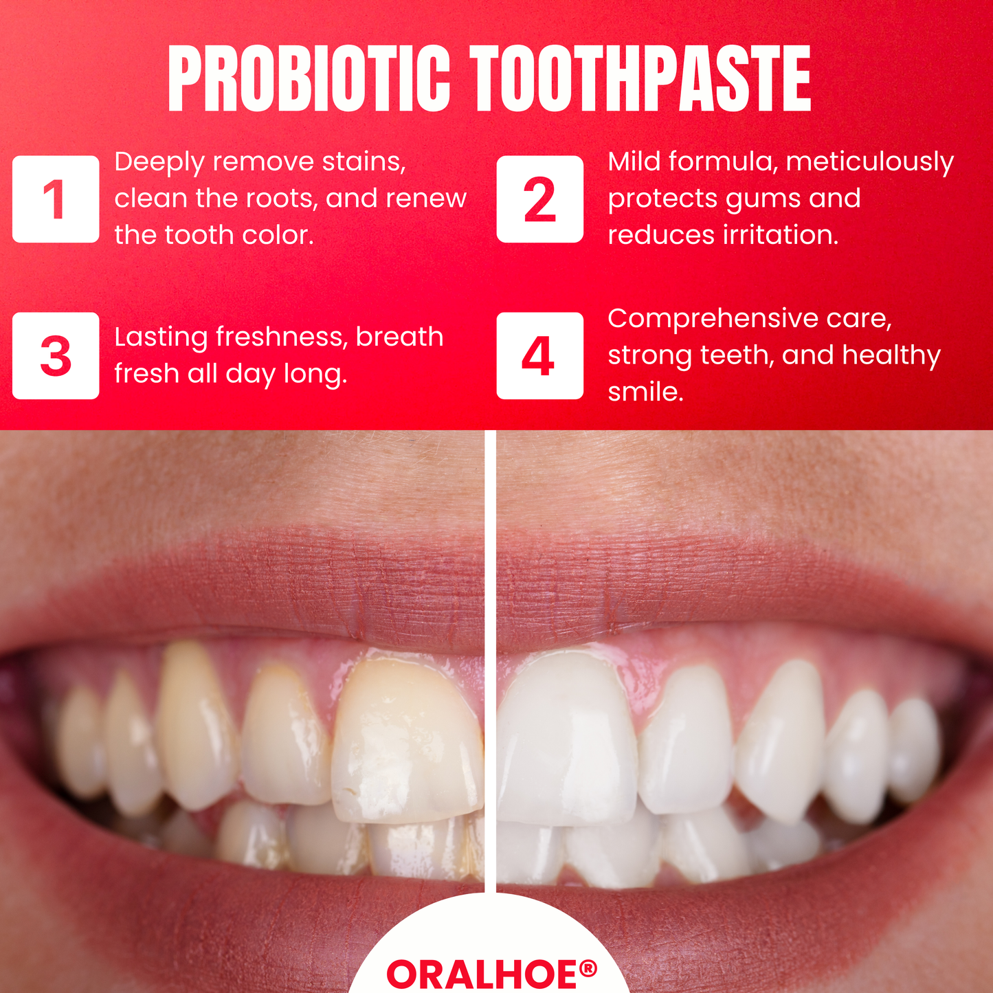 Oralhoe® SP8 Probiotic Toothpaste