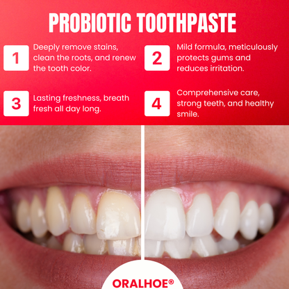 Oralhoe® SP8 Probiotic Toothpaste